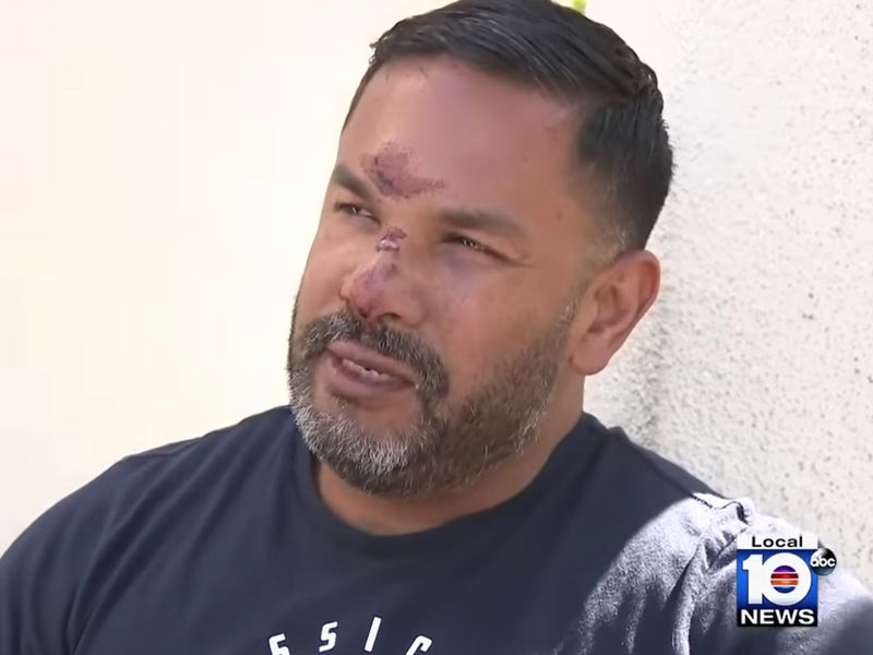 Man W/His Dog Asked if Gay/He is Beaten/ Fl Refuses toCharge HateCrime